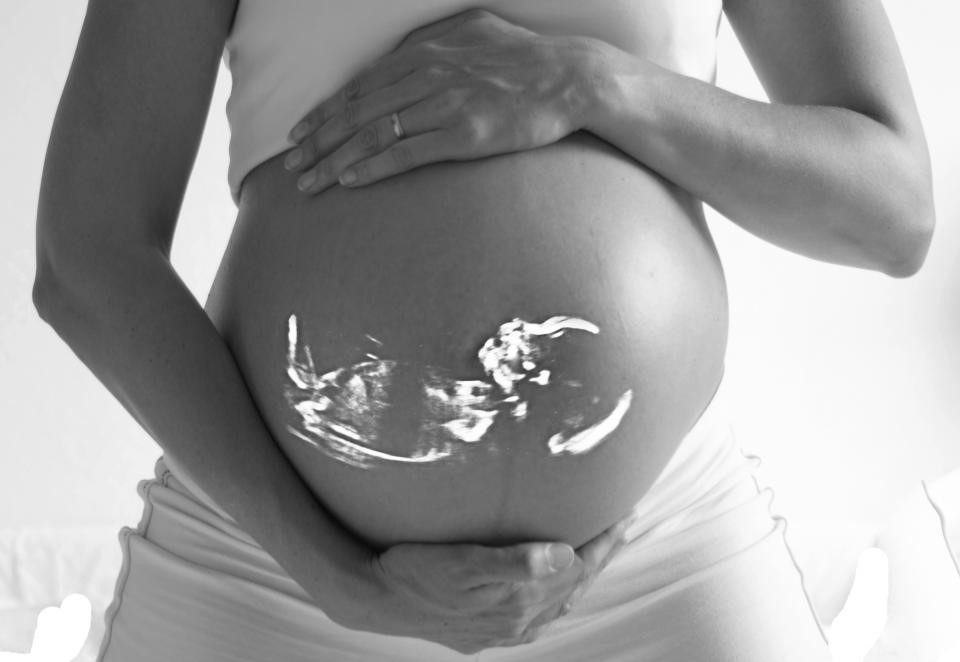 Gezondheidsraad: maak NIPT beschikbaar voor alle zwangeren