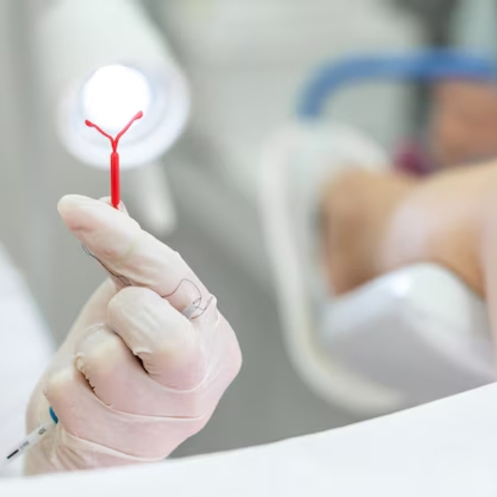 Vaginal zuluklar sharhlari Qizlarning orqadan yaqindan suratlari